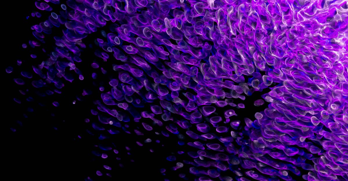 Octopus Arms House Most Neurons: Inside Distributed Intelligence